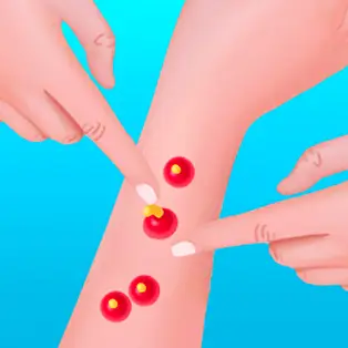 Pimple Poper Rush